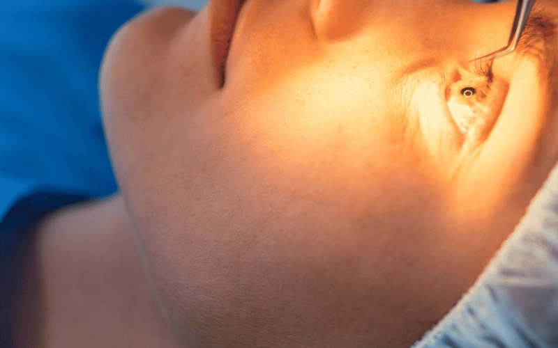 Invisalign, LASIK, and More: What Your Vision Plan Might Cover