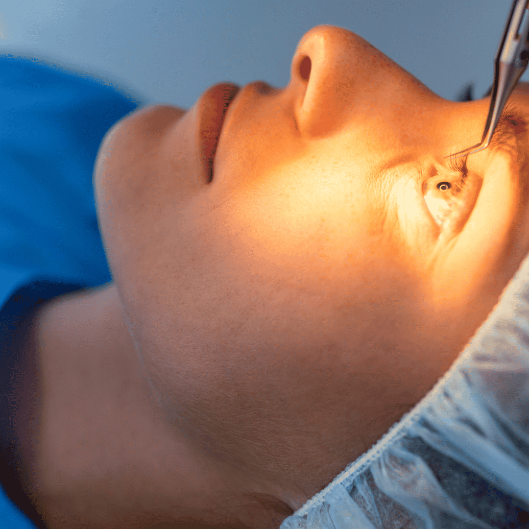 Invisalign, LASIK, and More: What Your Vision Plan Might Cover